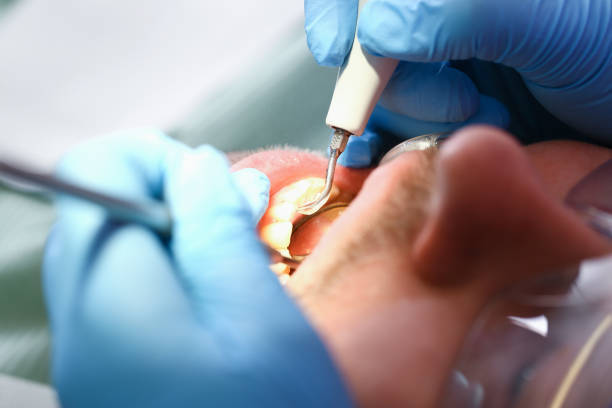 Best Emergency Dental Services for Seniors in Paterson, NJ