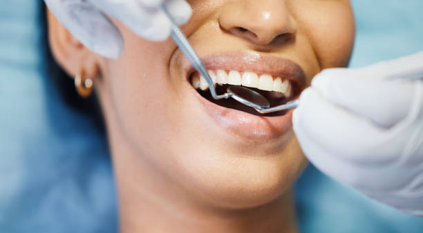 Best Emergency Dentist for Lost Fillings or Crowns in Paterson, NJ